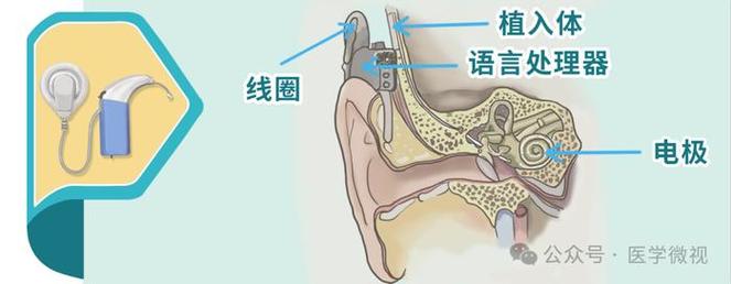 辅助电极翻译